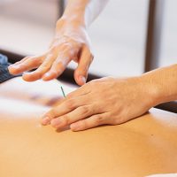 Can you exercise after an acupuncture treatment?