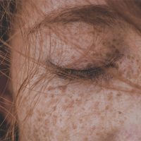 Eyelid hygiene – why you should care