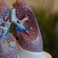 How To Reduce Your Chances of Developing Lung Cancer