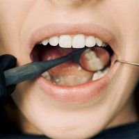 The Comprehensive Guide to the Importance of Gum Health in Oral Care
