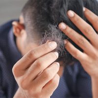 Addressing Hair Loss: Options for Everyone