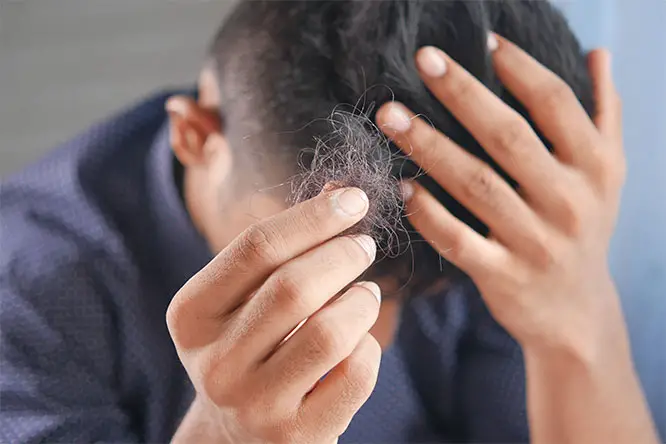 Addressing Hair Loss: Options for Everyone