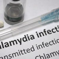 The Signs and Symptoms of Chlamydia: What To Do