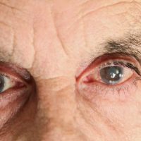 The Signs & Symptoms Of Glaucoma: What To Do